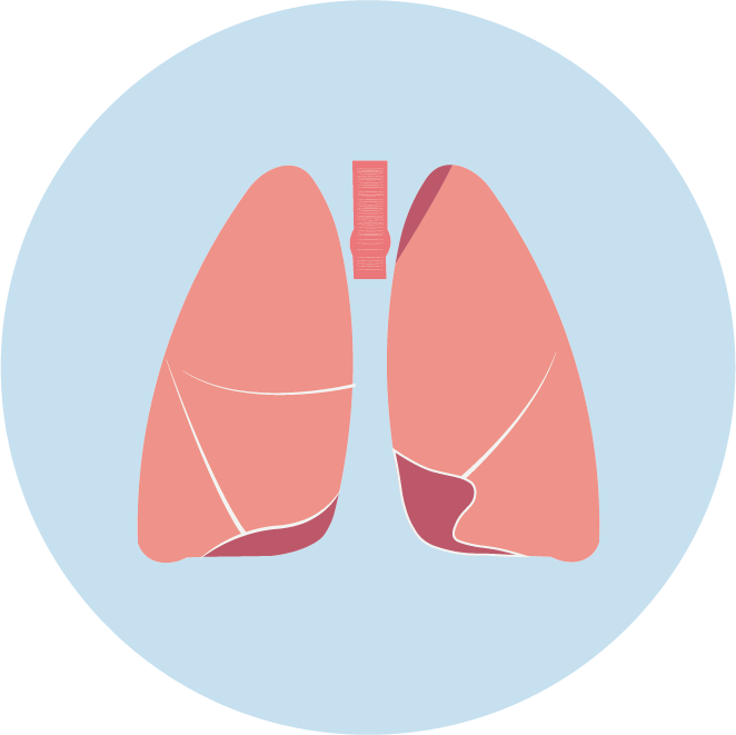 <b>【巅峰国际基因检测】非小细胞肺癌靶向治疗药物泰圣奇基因检测</b>